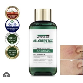 โทนเนอร์ Medipickme  All green tox 150 ml