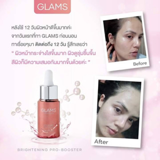 GLAMSเซรั่มแกลมส์ผิวฟูชุ่มชื้น