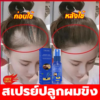 EELHOE 30ml สเปรย์ขิงปลูกผม สเปรย์ปลูกผมขิง เซรั่มปลูกผม ป้องกันผมร่วง น้ำยาปลูกผม สเปรย์ เร่งผมยาว Hair Growth