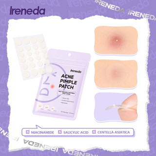 🌿 แผ่นแปะสิว Ireneda แบบบางพิเศษ กันน้ําขนาด 0.1 มม. สําหรับซ่อมแซมสิว ดูแลผิว ซ่อมแซมใบหน้า ผิวแพ้ง่ายก็ใช้ได้