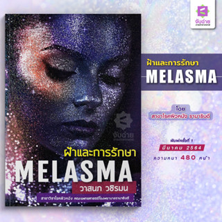 ฝ้าและการรักษา (Melasma)