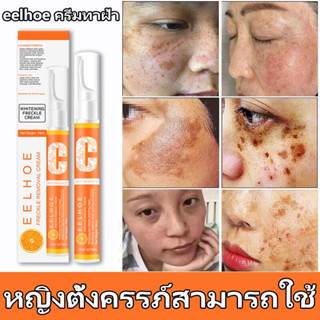 ครีมกำจัดฝ้าeelhoe ทาฝ้า ครีมแก้ฝ้าถาวร ครีม แก้ ฝ้า กระ ครีมแก้ฝ้าแท้ๆ vitamin c วิตตามินซีครีม กำจั จุดด่างดำ กระ 15g.