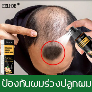 💧ปฏิเสธผมบาง💧 EELHOE ยาปลูกผมผู้ชาย สเปรย์ป้องกันผมร่วงราก 30ml เร่งการงอกใหม่น้ำยาปลูกผม เซรั่ม น้ำยาเร่งผมยาว ป้องกันไ