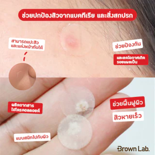 Brown Lab แผ่นแปะสิว Dr.dreamderm Spot Patch 18 ชิ้น 1 Box