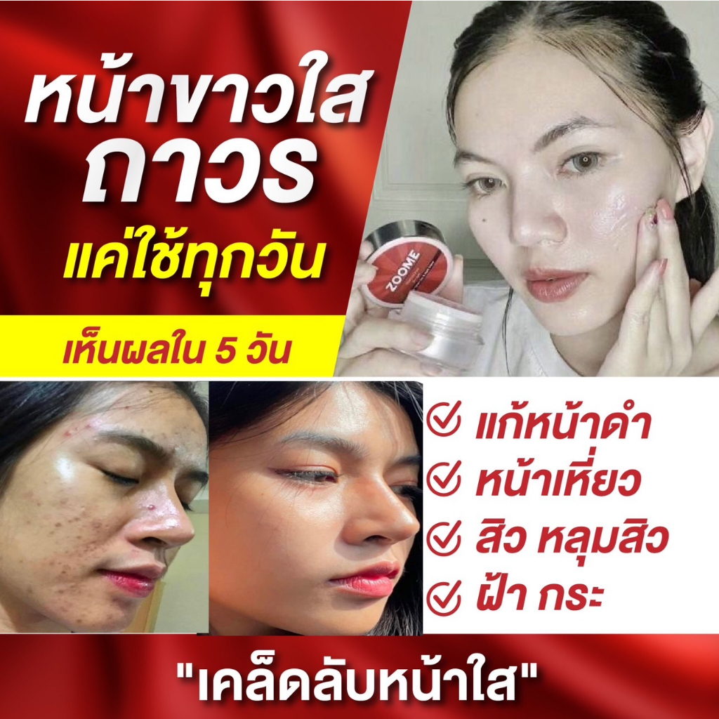 Zoome ครีมหน้าขาว ครีมหน้าใส ไนท์ครีม ขั้นเทพ ครีมบำรุงผิวหน้า ครีมรักษาสิว  ฝ้า Night Cream ครีมหน้าขาวใส เห็นผลใน 7 วัน | Shopee Thailand