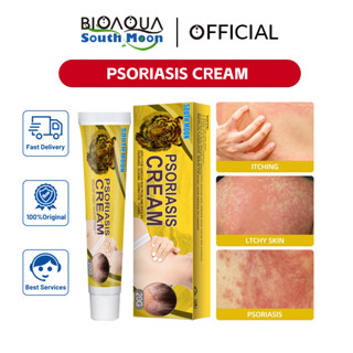 South Moon เสือโรคสะเก็ดเงินครีม Tiger Psoriasis Cream Chinese Herbal Medicine Tiger Label Paste Itching Psoriasis