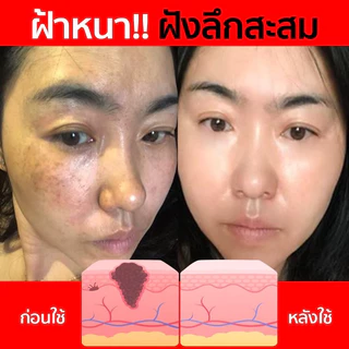 พิเศษ[1+1] 𝗠𝗶𝗻𝗻𝗶𝘀𝗲 𝗔𝗿𝗯𝘂𝘁𝗶𝗻𝗖+ เซรั่มลดฝ้ากระหน้าเงา โดสเข้มข้น