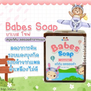 Babes Soap บาเบส โซฟ สบู่แก้คัน ขาลาย แพ้ยุง