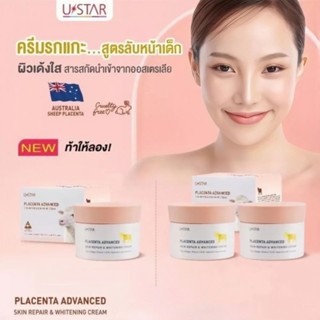 ⚡️ครีมรกแกะ⚡️Ustar ยูสตาร์ พลาเซนต้าไวท์เทนนิ่งครีม 100กรัม (Exp:01/25)