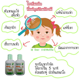 ดีจริงแชมพู่ กำจัดเหาผิงอันเฮอแบ็ล กำจัดเหาภายใน 5 นาที กำจัดเหาได้ง่ายง่าย ไข่ฝอ เหาหลุด สบายหัว ปลอดภัยหยุดคันใน5-10นา