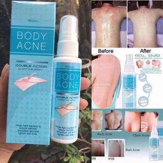 Mistine Body Acne Double Action Clarifying Spray 50 ml.มิสทิน บอดี้ แอคเน่ ดับเบิ้ล แอคชั่น แคลริฟายอิ้ง ขนาด50มล.