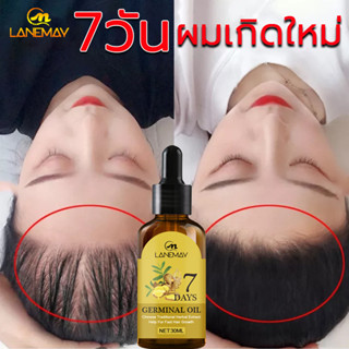 🔥ของแท้100% LANEMAYเซรั่มปลูกผม ปลูกผม น้ำยาเร่งผมยาว เซรั่มขิงบำรุงผม ป้องกันผมร่วง ปรับปรุงคุณภาพของเส้นผม Hair Growth