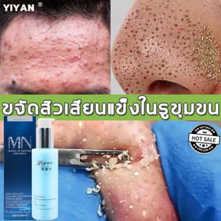 YIYAN เซรั่มกระชับรูขุมขน 120ml เซรั่มบำรุงผิวหน้า เอสเซนส์บำรุงผิวหน้า เซรั่มหน้าใส ทำความสะอาดรูขุมขน รูขุมขนหดตัว