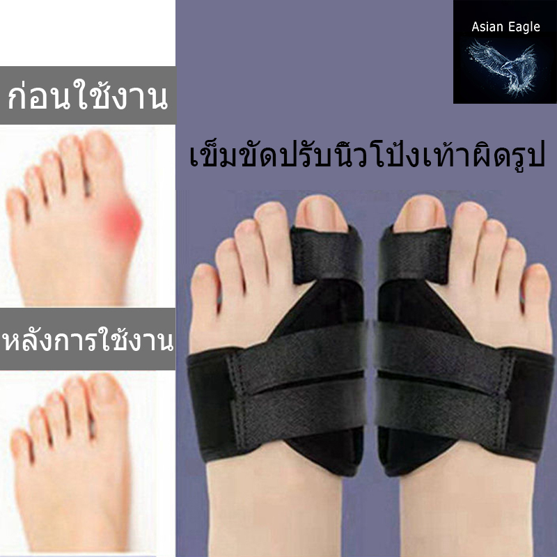 สินค้ามีพร้อมส่ง สวมได้ทั้ง2 ข้าง อุปกรณ์แก้ไขเท้าผิดรูป สำหรับผู้มีนิ้วโป้งเท้าเอียง ดัดเท้า เท้าเก เท้าเอียง เท้าเฉ