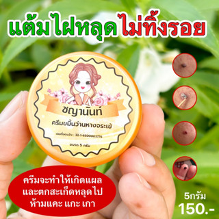 ครีมไฝชญานันท์ขมิ้นวานห่างจระเข้ ไฝ ขี้แมลงวัน ติ่งเนื้อ หูด ตาปลา ปาน จบทุกปัญหา