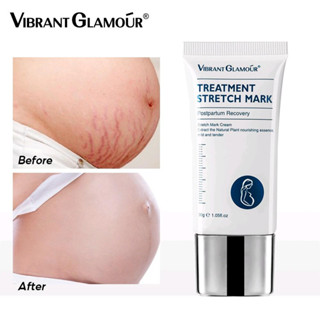 [Vibrant Glamour] ครีมลดรอยแตกลายก่อนคลอด-​หลังคลอด​ ผิวแตกลาย รอยแตกลาย​ Treatment Stretch Mark 30g