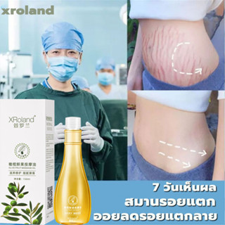 XRoland ครีมลดรอยแตก 150g ขาแตกลาย ลดรอยแตกลาย ครีมทาท้องลาย ครีมลดรอยแตกลาย แก้ท้องลาย กระชับผิวให้เรียบเนียน