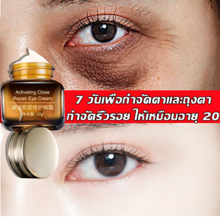 【ของแท้ พร้อมส่ง】ครีมบำรุงรอบดวงตา 20G ดูแลรอบดวงตาและ ครีมลดถุงใต้ตา ลดรอยคลำ้ใต้ตาลด ริ้วรอย