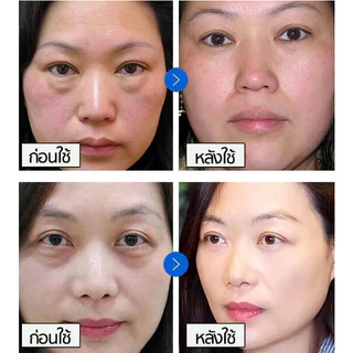 【ของแท้ พร้อมส่ง】ครีมบำรุงรอบดวงตา 20G ดูแลรอบดวงตาและ ครีมลดถุงใต้ตา ลดรอยคลำ้ใต้ตาลด ริ้วรอย