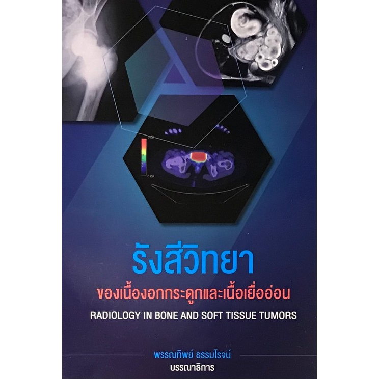 c111 รังสีวิทยาของเนื้องอกกระดูกและเนื้อเยื่ออ่อน (RADIOLOGY IN BONE ANDSOFT TISSUE TUMORS)รังสีวิทย