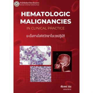 c111 มะเร็งทางโลหิตวิทยาในเวชปฏิบัติ (HEMATOLOGIC MALIGNANCIES IN CLINICAL PRACTICE) 9786164263048