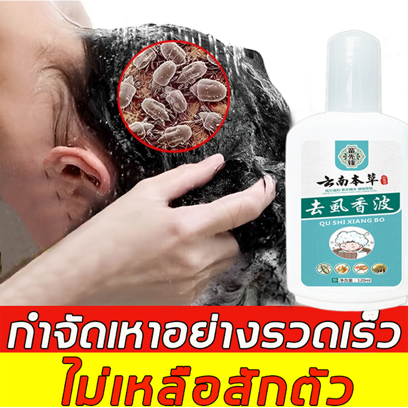 แชมพูกำจัดเหา สูตรสมุนไพร ยาฆ่าเหา กำจัดเหาและไข่ แก้คัน กลิ่นหอม อ่อนโยน ยาสระผมฆ่าเหา ยาฆ่าเหา น้ำยากำจัดเห่า 120 ml