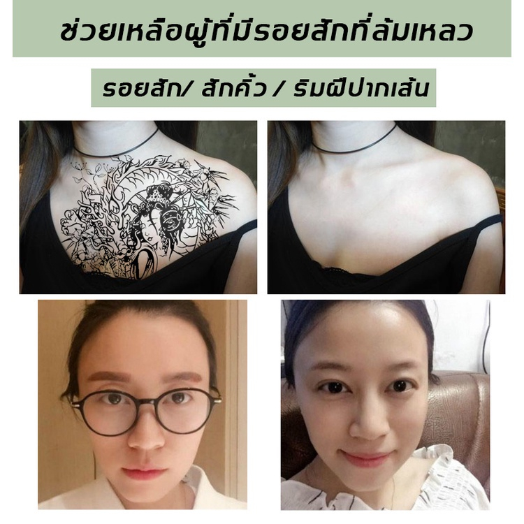 น้ำยาลบรอยสัก ครีมทาลบรอยสัก น้ำลบรอยสักคิ้ว ที่ลบรอยสัก ครีมรอยสัก น้ำลบรอยสัก ไม่ทำร้ายผิว ไม่มีแผลเป็น - รูปที่ 4