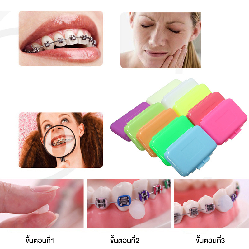 ขี้ผึ้งสำหรับคนจัดฟัน ช่วยป้องกันการระคายเคือง การเกิดแผลจากการบาดในช่องปาก มีหลายกลิ่น ขี้ผึ้งจัดฟัน - รูปที่ 2