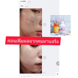(ซื้อ1แถม1)กลูต้า1กระปุกแถมฟรีวิตามินซีลดสิว