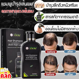 Dexe hair shampoo แชมพูบำรุงหนังศรีษะลดการ ผมขาด ผมร่วง ผมบาง