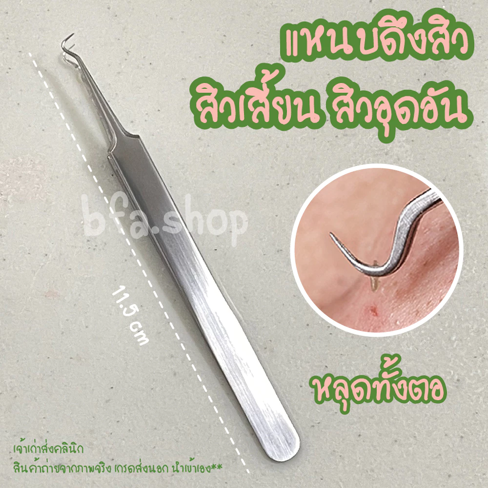 แหนบดึงสิวสแตนเลส Butterfly ที่ดึงสิวเสี้ยน กำจัดสิวเสี้ยน