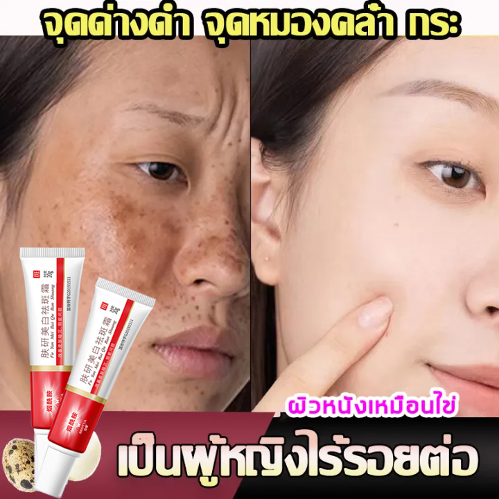 ครีมทาฝ้า กระ จุดด่างดำ HUMEI เซรั่มฝ้ากระ เพื่อผิวหน้ากระจ่างใส ลดเลือน ฝ้า กระ จุดด่างดำ