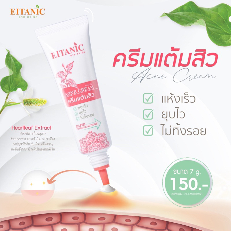 แอคเน่ครีม acne cream (ครีมแต้มสิว)
