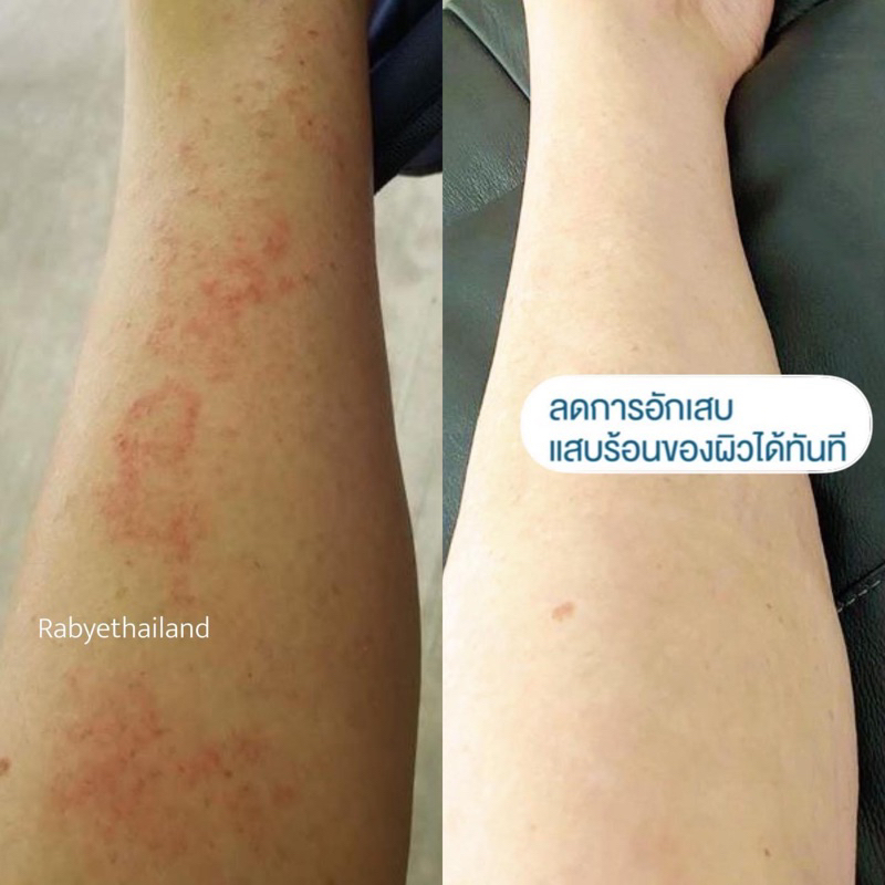 OPO | Rabye Mineral​ Shower สบู่เหลวน้ำแร่ ลดผดผื่นคัน​ ผิวอักเสบแดง แพ้ง่าย​ น้ำเหลืองไม่ดี ราคา ถูกที่สุด ดีลบีเคเค แกลเลอรีภาพที่ 7