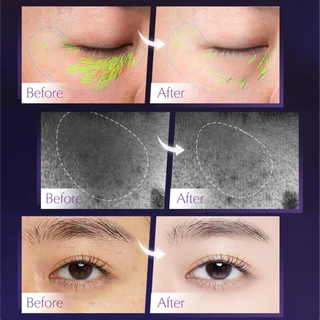 M339 HIH Retinol อายครีม เซรั่ม ลดริ้วรอย ลดรอยคล้ําใต้ตา กระชับผิวรอบดวงตา