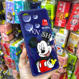 เคสTPU การ์ตูนหลังเงาสำหรับรุ่น Infinix Note30 4G/5G‼️สินค้าพร้อมส่งในไทย🚛🚛