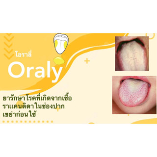 ผลิตภัณฑ์รักษาเชื้อราในช่องปากเเคนดิดา เขย่าก่อนใช้ (Oraly 15ml )