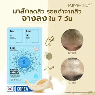 มาร์คหน้า ลดสิว บำรุงผิวแบบ 3 step Mask Acne Kimroly made in korea ของแท้ สำหรับผิวแพ้ง่าย สารกัดจากรังนกและวิตามินรวม