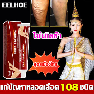 EELHOE ครีมทาเส้นเลือดขอด ยาทาเส้นเลือดขอด ส่งเสริมการไหลเวียนเลือดบรรเทา