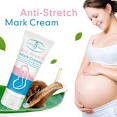 ❤️Love Sale❤️Aichun Beauty ครีมลดรอยแตกลาย Anti-Stretch Mark Cream ครีมทาท้อง ผิวแตก ขาลาย ทาสะโพก 60 g