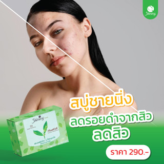 [ ส่งฟรี ไม่ต้องใช้โค้ด ]  Shining Soap  ลดสิว ผิวขาว