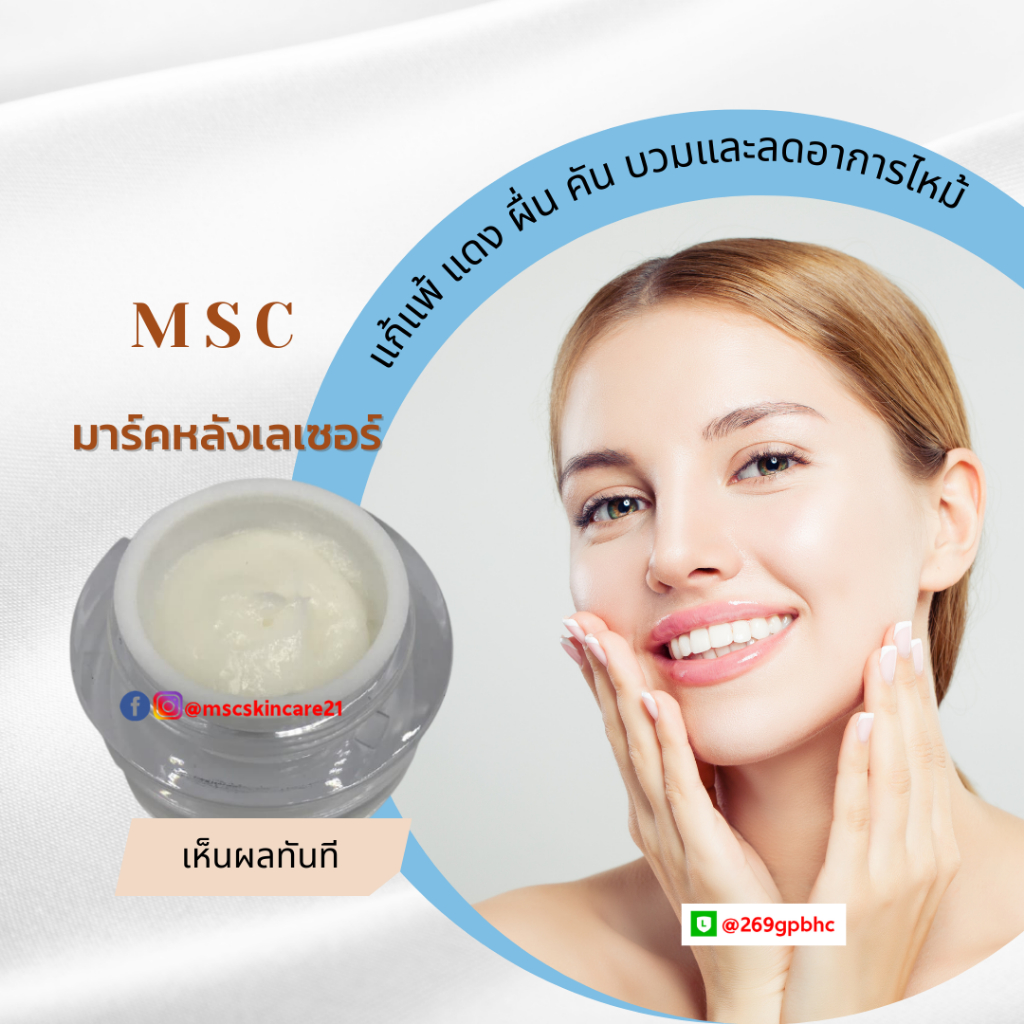 🔷MSC>>มาร์คแก้แพ้ แดง ผื่น คัน บวมและลดอาการไหม้มาร์คหลังทรีทเม้นท์เห็นผลทันที