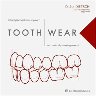 Tooth Wear (Hardcover)/Didier Dietschi ISBN:9781786981158