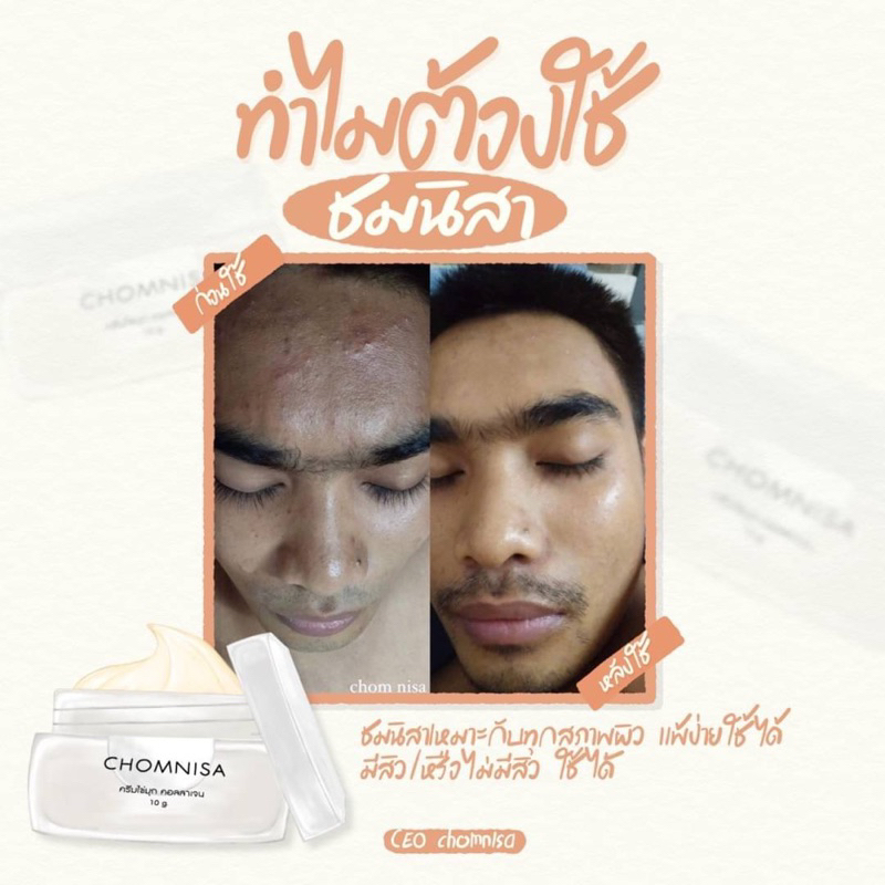 ครีมชมนิสา ครีมบำรุงก่อนนอน ช่วยในเรื่องสิว ฝ้า กระ รอยดำ รอยแดง กระชับรูขุมขน CHOMNISA - รูปที่ 7