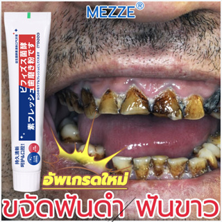 ทันตแพทย์เองก็ใช้มัน👨‍⚕️Mezze ยาสีฟันฟันขาว ฟันเหลือง ฟันดํา คราบกาแฟ คราบบุหรี่ ยาสีฟันลดหินปูน