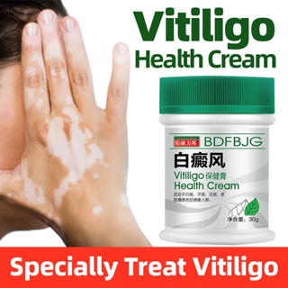 ครีมบํารุงผิวรักษาจุดด่างดํา Leukoplakia ผิวด่างขาวครีมสมุนไพรจีน Vitiligo Health Cream