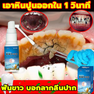 ⚡️เอาหินปูนออกใน 1 วินาที น้ำยากำจัดหินปูน 30ML ขจัดคราบหินปูน น้ำยากำจัดหินปูน ยาสีฟันฟอกฟันขาว Dental stone spray