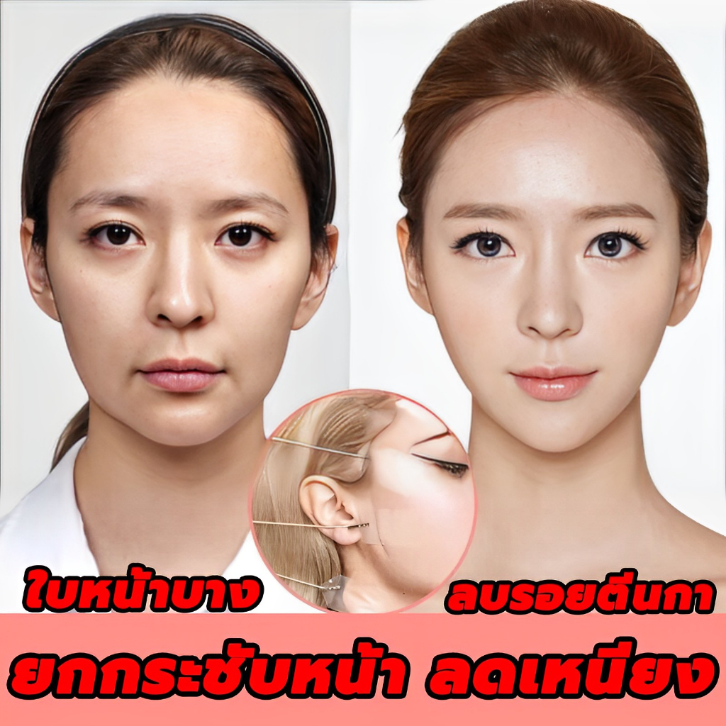 ✨ ที่ดึงหน้า V-Shape ยกหน้าเรียว ลดโหนกแก้ม ✨ West Month ที่ดึงหน้า เทปดึงหน้า แผ่นแปะหน้าเรียว กล่อ