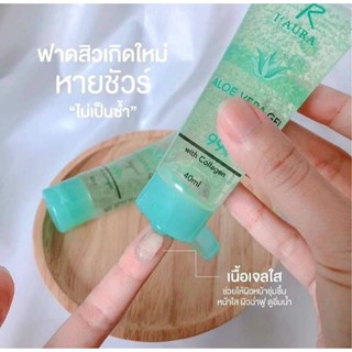 💥ขายดีมาก💥เจลว่านหางจระเข้ 40ml1หลอดเจลสยบสิวเอาอยู่ ဝက်ခြံ​ပြောက်ဂျယ်