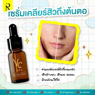 ของแท้ เซรั่มหน้าใส วิตซีเซรั่ม / racha ครีมน้องฉัตร